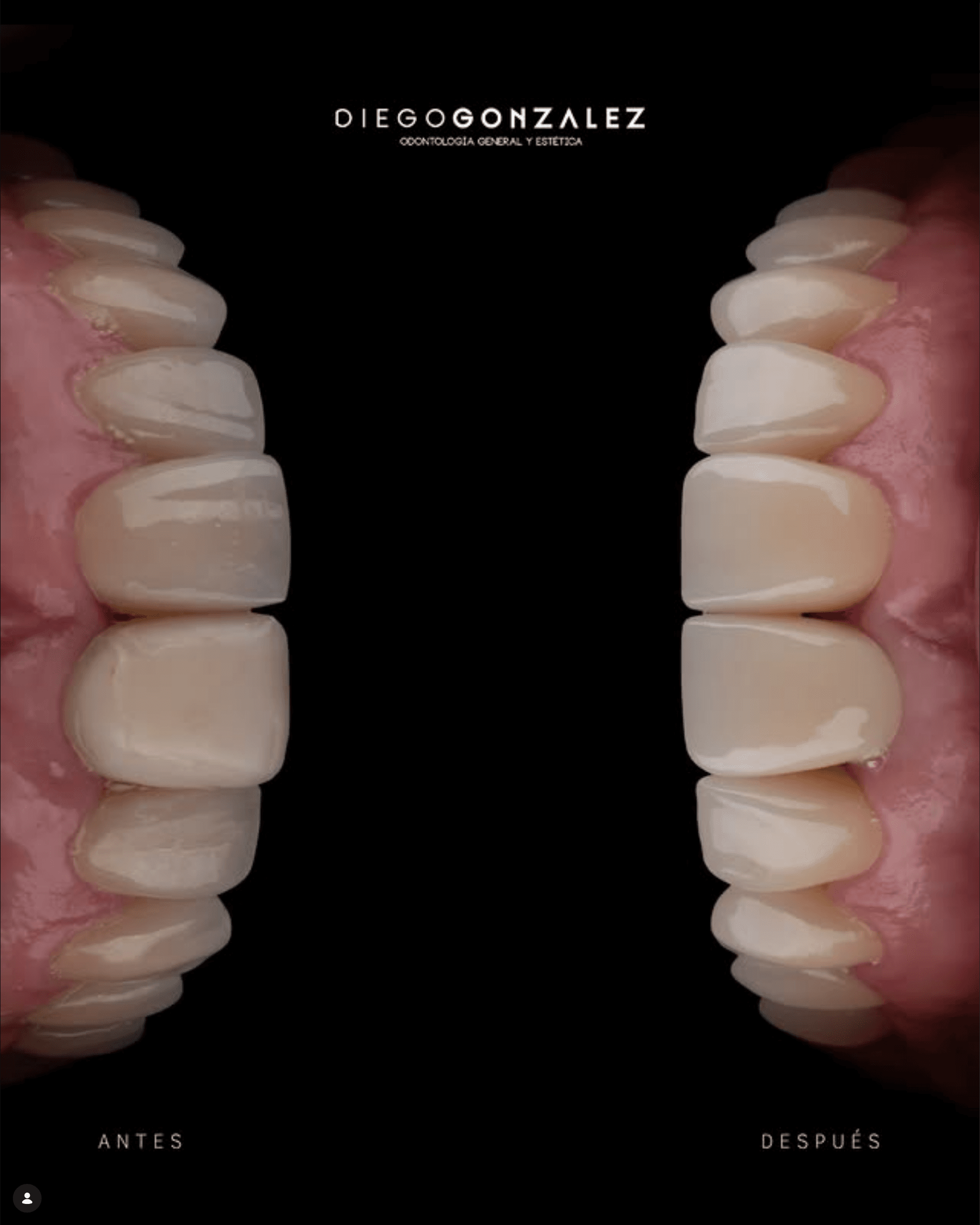 Diseño de Sonrisas