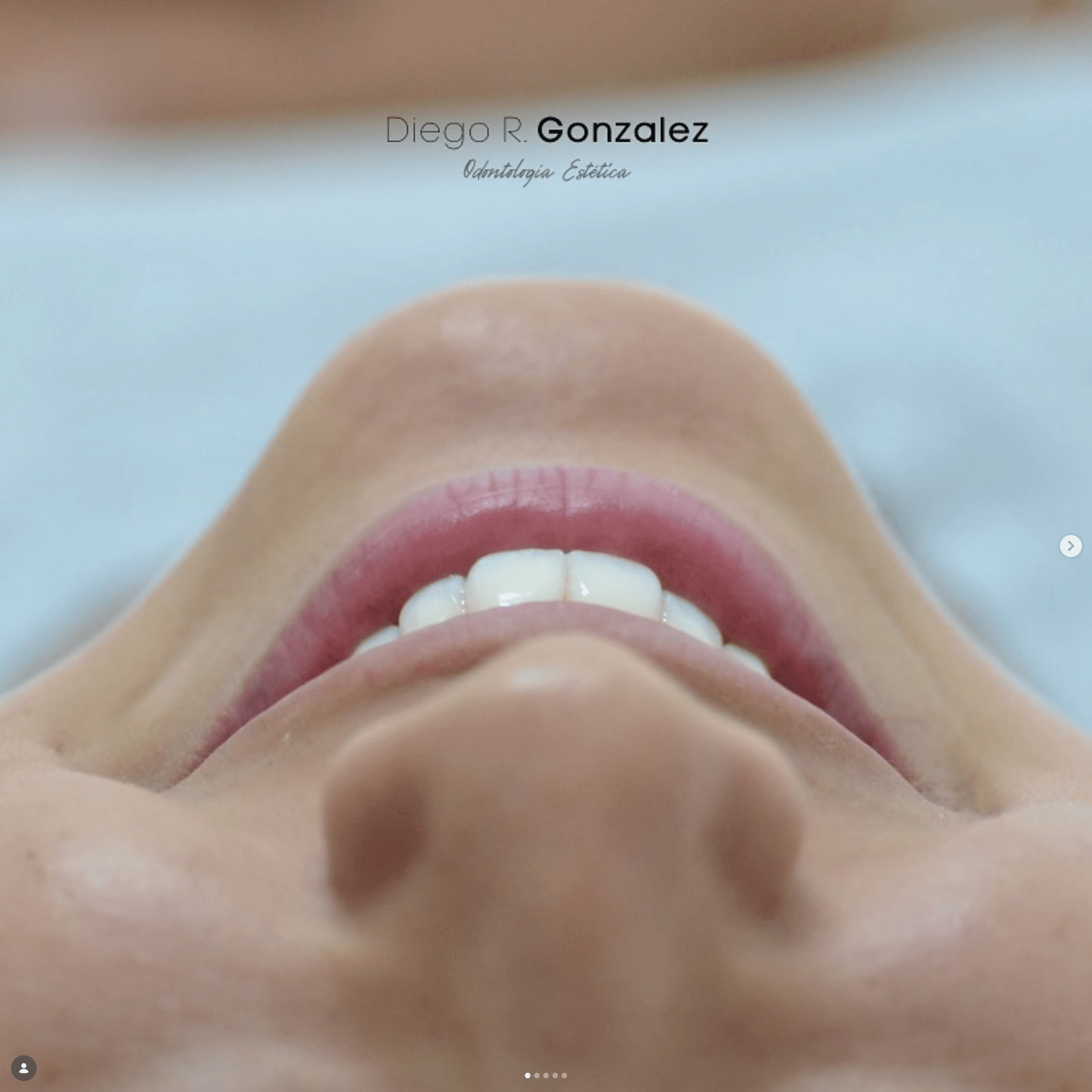 Sonrisa en detalle